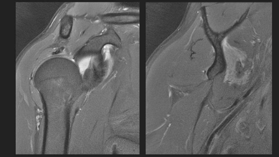 Figure 5 for case dislocation ( RID4770 )